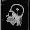 homer simpson x ray brain.jpg